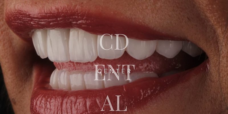 dentist-belgrade-c-dental-center-11