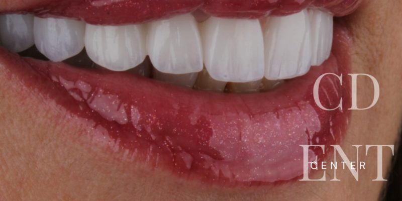 dentist-belgrade-c-dental-center-13