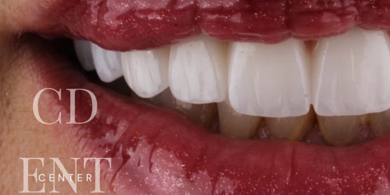 dentist-belgrade-c-dental-center-14