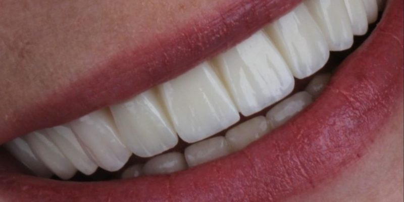 dentist-belgrade-c-dental-center-16