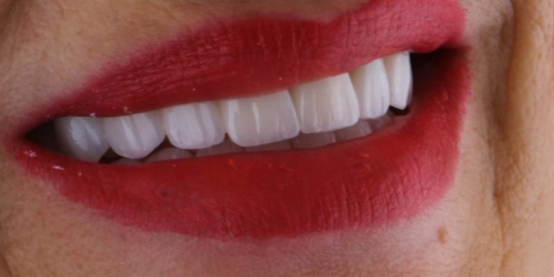 dentist-belgrade-c-dental-center-19