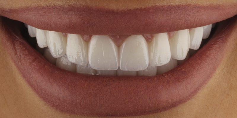dentist-belgrade-c-dental-center-21